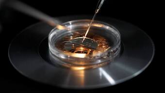 IVF Fiasco: Delhi hospital impregnated woman with unknown donor’s sperm, not husband’s; fined Rs 1.5 crore