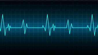 Siblings listen to their dad's heartbeat 4 years after his death; here's how they did it