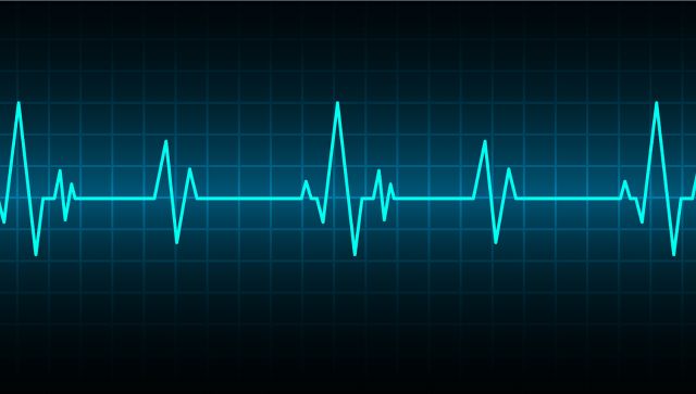 Siblings listen to their dad's heartbeat 4 years after his death; here's how they did it Siblings listen to their dad's heartbeat 4 years after his death; here's how they did it