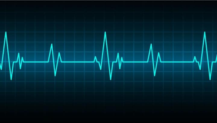 Siblings listen to their dad's heartbeat 4 years after his death; here's how they did it