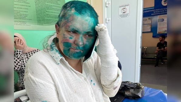 Russia launches criminal inquiry into brutal beating of award-winning reporter