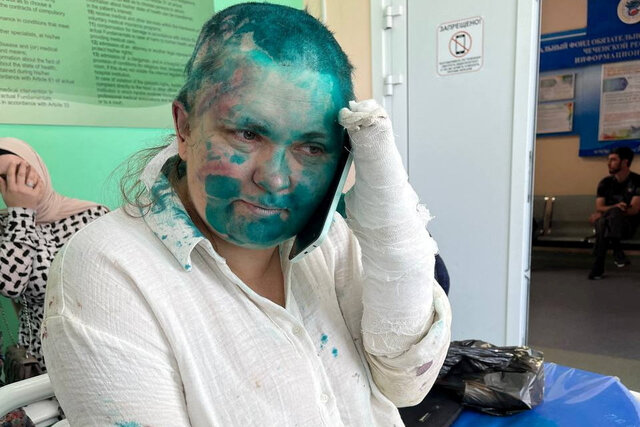 Russia launches criminal inquiry into brutal beating of award-winning reporter Russia launches criminal inquiry into brutal beating of award-winning reporter