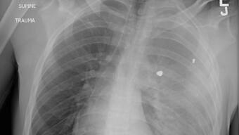 'Guns are the no.1 reason of death for US children and teens'