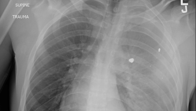 'Guns are the no.1 reason of death for US children and teens' 'Guns are the no.1 reason of death for US children and teens'