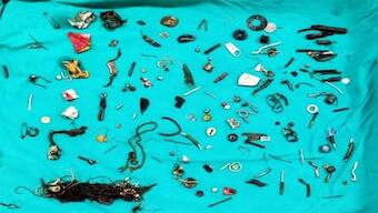 Doctors extract rakhis, nails from Punjab man’s stomach: Why do people swallow weird items?