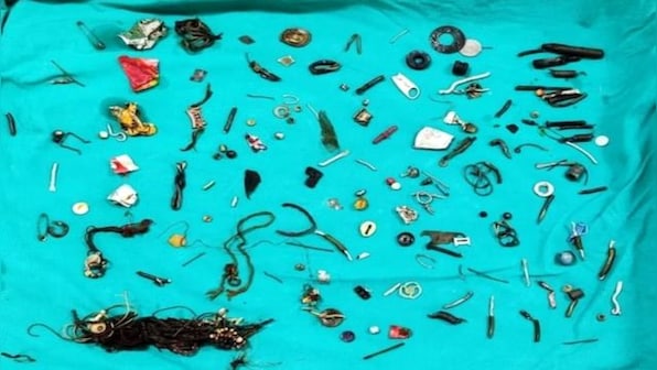 Doctors extract rakhis, nails from Punjab man’s stomach: Why do people swallow weird items?