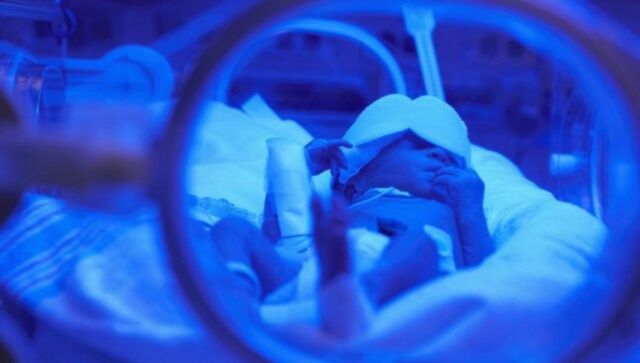 India had world's highest number of preterm births in 2020: Lancet study India had world's highest number of preterm births in 2020: Lancet study