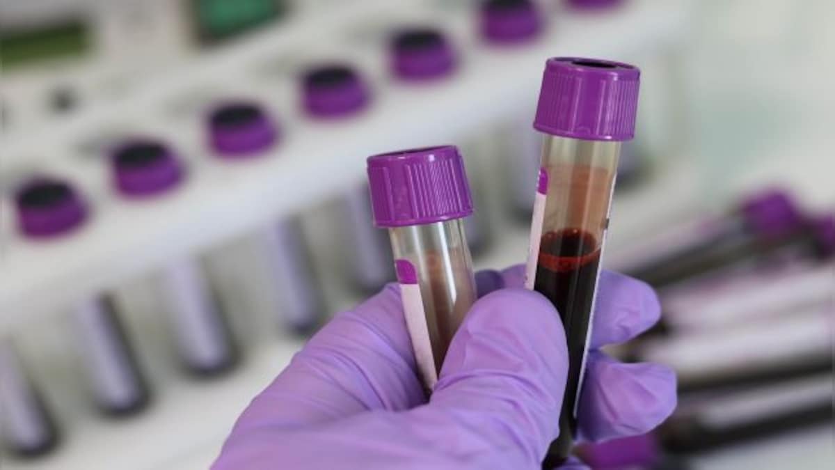 How a simple blood test could help diagnose bipolar disorder