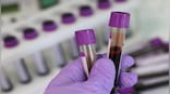 How a simple blood test could help diagnose bipolar disorder