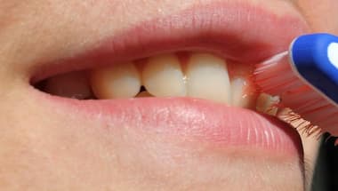 In Graphics | The four-step guide to acing white teeth and the perfect smile