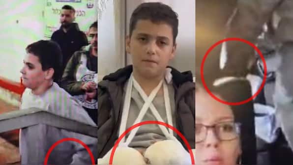 WATCH Hamas shenanigans smashed: Teen 'terrorist' freed by Israel wears false cast on hands, caught lying on camera