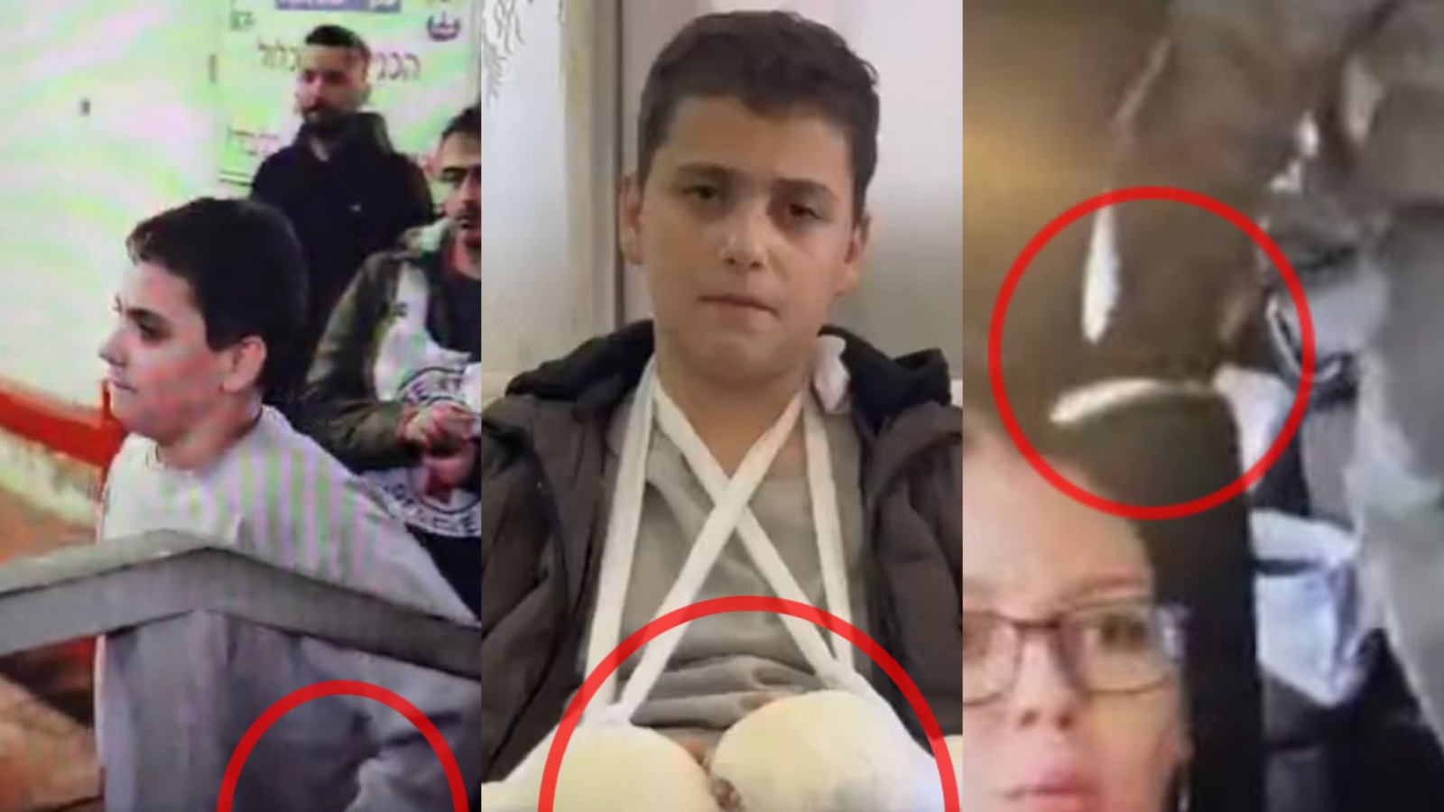 WATCH Hamas shenanigans smashed: Teen 'terrorist' freed by Israel wears false cast on hands, caught lying on camera WATCH Hamas shenanigans smashed: Teen 'terrorist' freed by Israel wears false cast on hands, caught lying on camera
