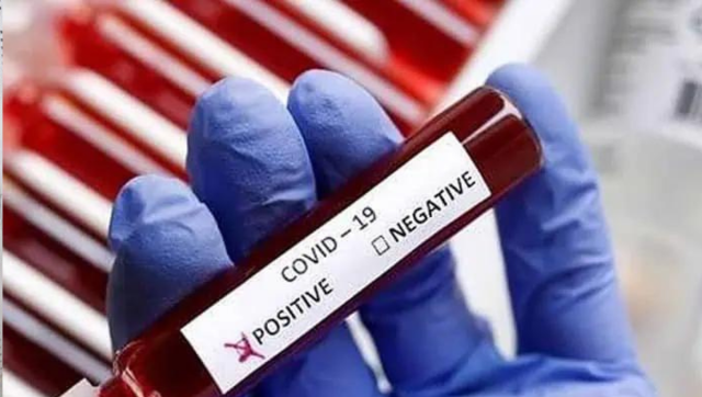 Experts allay fears on JN.1 Covid variant in India Experts allay fears on JN.1 Covid variant in India