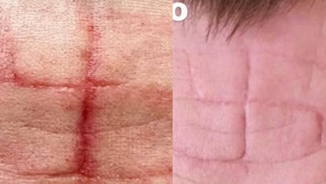 Russians accused of carving swastikas on captured Ukrainians Russians accused of carving swastikas on captured Ukrainians