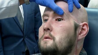 Always hooked to digital screens? You may have dry eyes