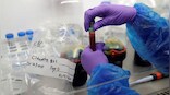 1 state, multiple outbreaks: Why Kerala is often the first to record diseases