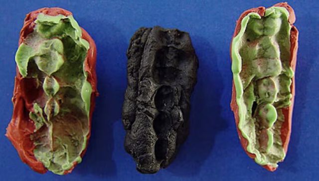 Prehistoric ‘chewing gum’ sheds light on stone age teenagers’ diet and disease Prehistoric ‘chewing gum’ sheds light on stone age teenagers’ diet and disease