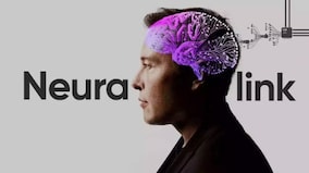 Neuralink has implanted brain chip in its first human patient, claims Elon Musk