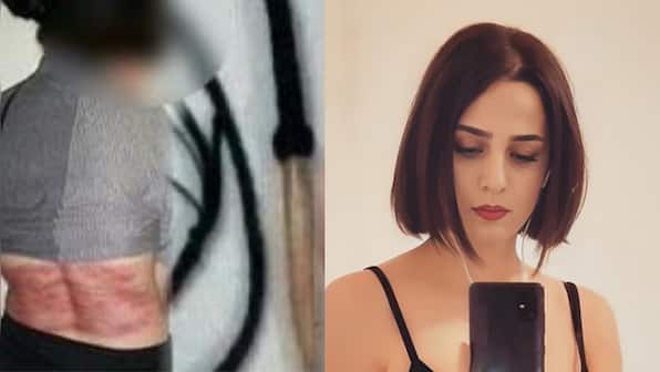 Iranian woman flayed 74 times for refusing to wear hijab