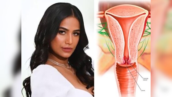 Cervical cancer EXPLAINED: Don’t need Poonam Pandey to raise awareness