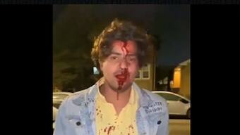 How an Indian student was brutally beaten in yet another attack in the US