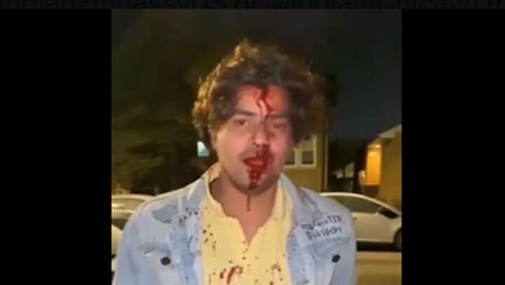 How an Indian student was brutally beaten in yet another attack in the US