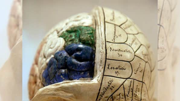 World Brain Day: Importance of raising awareness and early detection of brain tumours