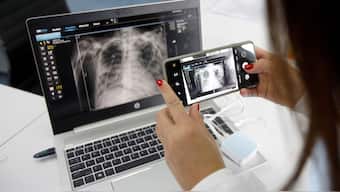 Representational Image.