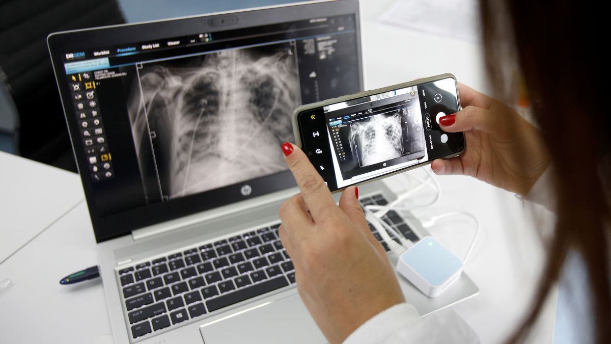 New AI model predicts irregular heartbeat 30 minutes in advance New AI model predicts irregular heartbeat 30 minutes in advance