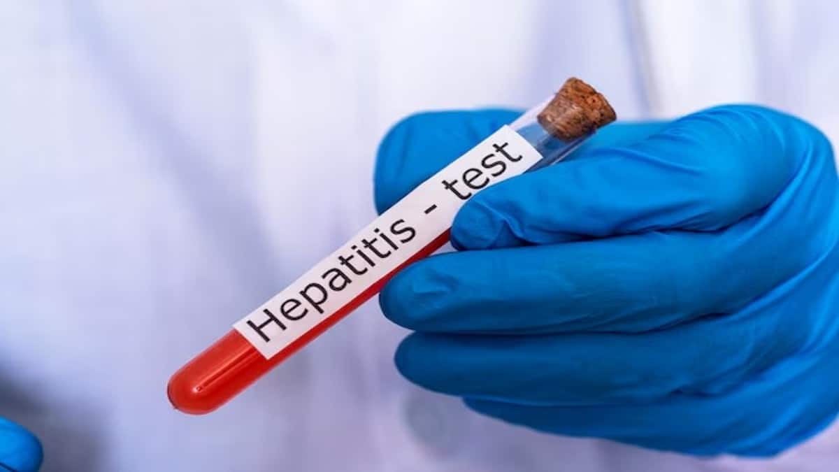 India among nations with highest hepatitis B and C cases: What are these infections, how to prevent them? – Firstpost