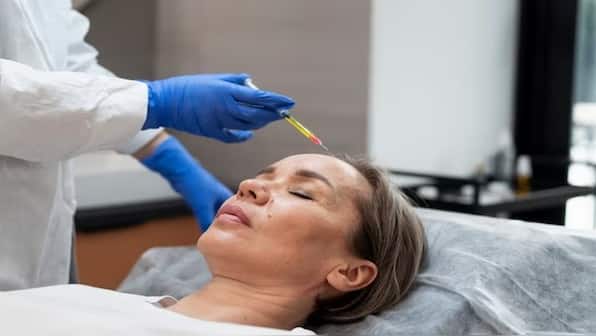 What are vampire facials giving American women HIV?
