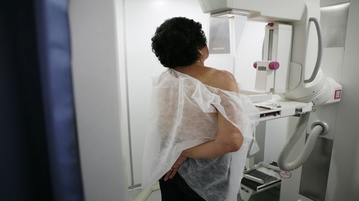 Why breast cancer screenings should start at the age of 40