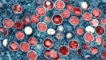This image shows a colourised transmission electron micrograph of monkeypox particles (red) found within an infected cell (blue), cultured in the laboratory that was captured and color-enhanced. NIAID via AP