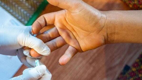 UN blames STDs for killing millions every year globally