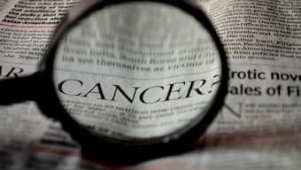 Cancer  was a well-known disease in the early fourth Century BC. Image used for representational purposes/Pixabay