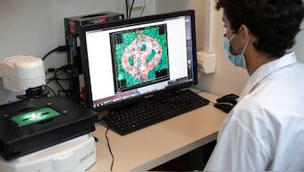 (File) Israeli researcher Eilam Yeini examines a microscope image of a blood vessel tube surrounded by cancer tissues, as part of a brain cancer research that uses patients' cells to make 3D printed models of tumours, at Tel Aviv University, Reuters