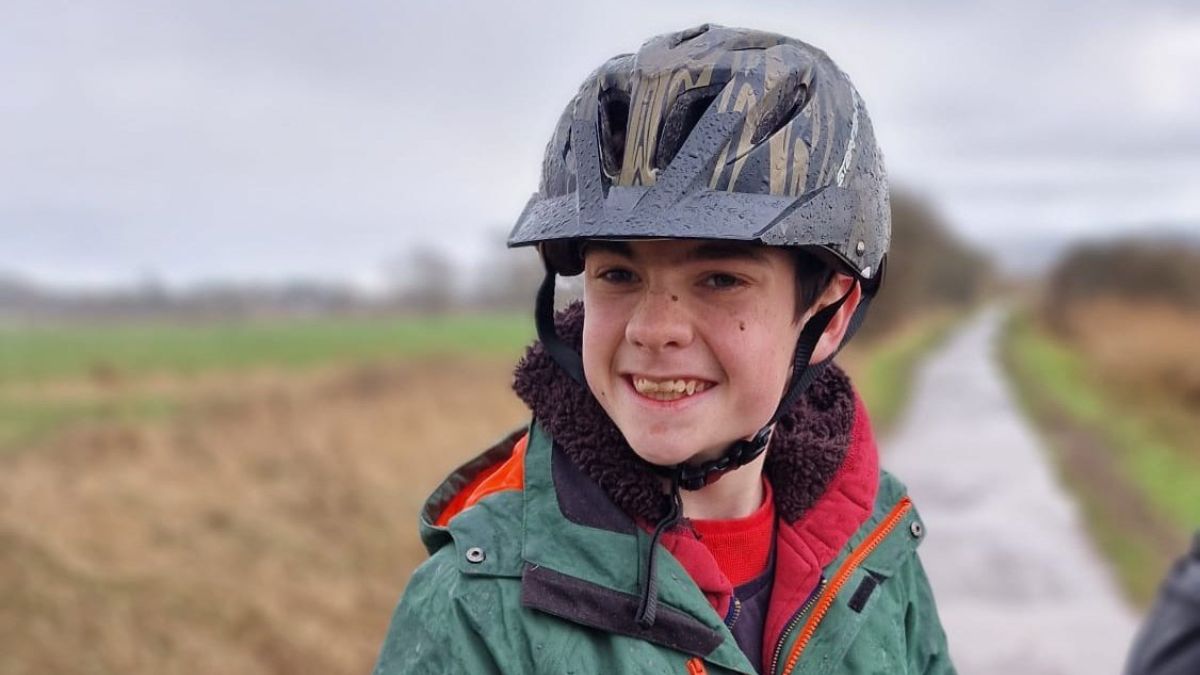 Thirteen-year-old Oran has made history as the first patient in the UK to participate in a clinical trial using deep brain stimulation (DBS) to treat epilepsy. gosh.nhs.uk Thirteen-year-old Oran has made history as the first patient in the UK to participate in a clinical trial using deep brain stimulation (DBS) to treat epilepsy. gosh.nhs.uk