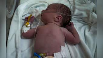 A Palestinian baby boy, not yet named, who was delivered prematurely after his mother Ola al-Kurd was killed in an Israeli strike, lies in an incubator at a hospital in Deir al-Balah. AP