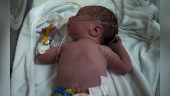  Gaza hospital delivers baby from dead mother's womb after airstrike