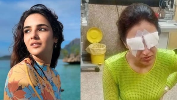 Television star Jasmin Bhasin suffers corneal damage due to mishap with her  lenses, says 'Went to see a doctor but…' – Firstpost