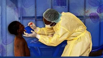 Mpox belongs to the same family of viruses as smallpox but causes milder symptoms like fever, chills and body aches, and mostly spreads through close skin-to-skin contact, including sexual intercourse. File Image/FP