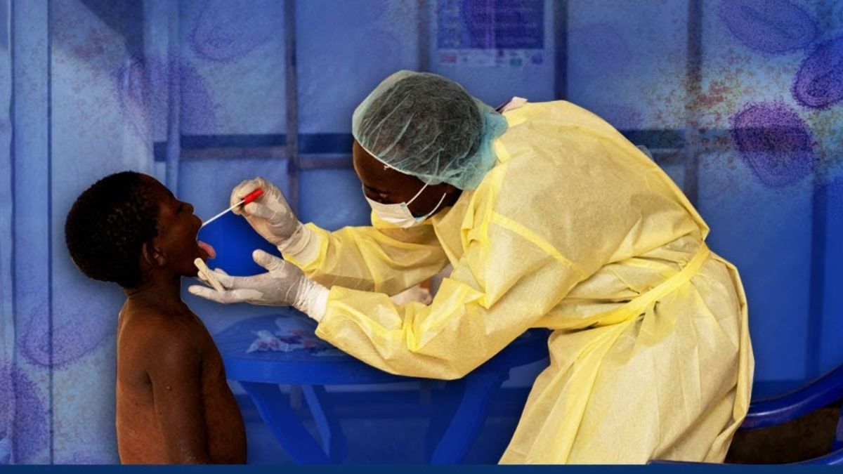 India has developed its own mpox RT-PCR testing kits. Here’s why this matters India has developed its own mpox RT-PCR testing kits. Here’s why this matters