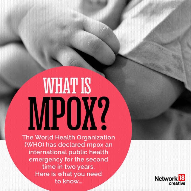 In Graphics | A Simple Guide To Understanding Mpox – Firstpost