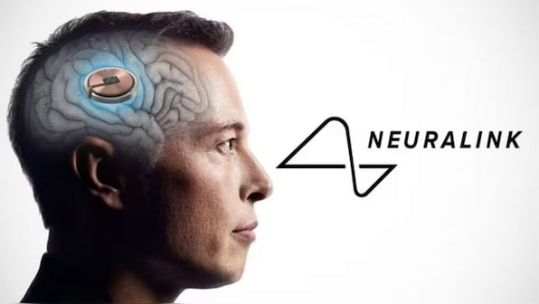 Neuralink successful with brain implant in 2nd patient, Elon Musk ...