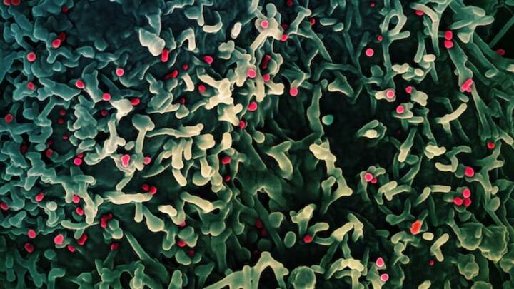 What is the highly-infectious Marburg viral disease that killed 6 in Rwanda?