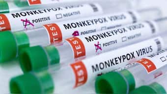 Test tubes labeled 'Monkeypox virus positive and negative' are seen in this illustration. Source: REUTERS.