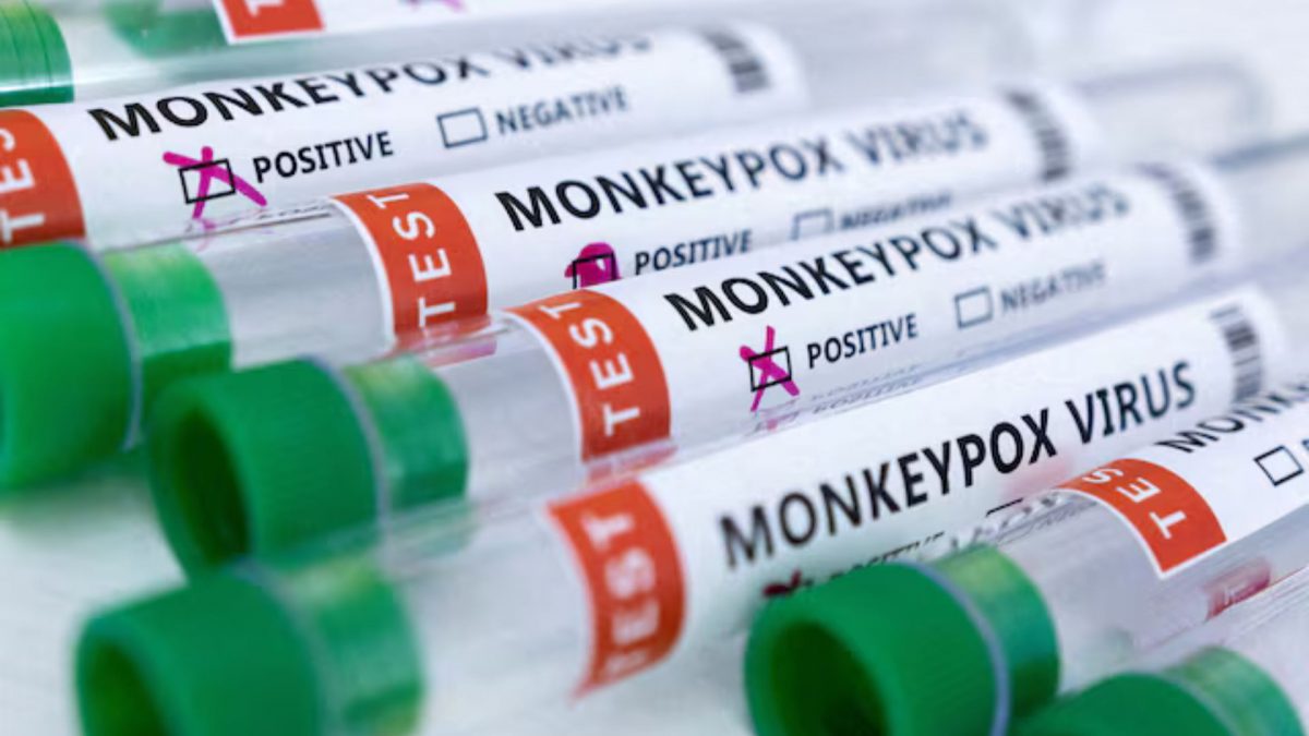Test tubes labeled 'Monkeypox virus positive and negative' are seen in this illustration. Source: REUTERS. Test tubes labeled 'Monkeypox virus positive and negative' are seen in this illustration. Source: REUTERS.