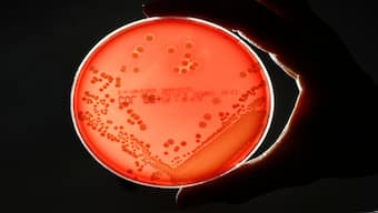 MRSA is a drug-resistant "superbug", which can cause deadly infections. Reuters