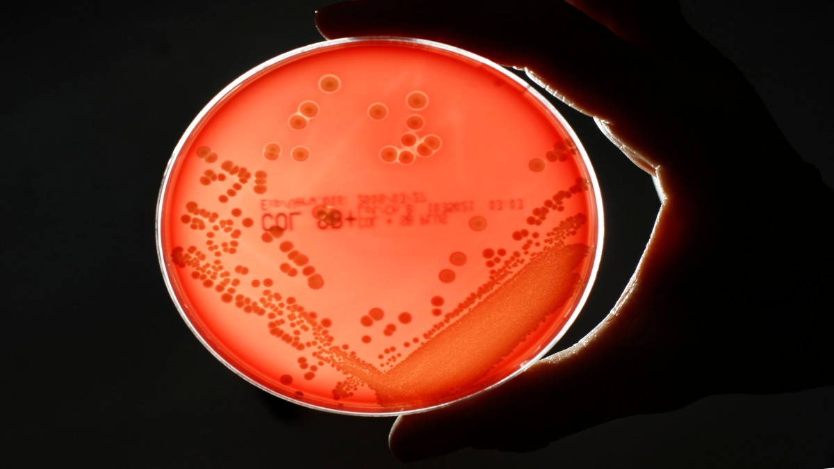 MRSA is a drug-resistant "superbug", which can cause deadly infections. Reuters MRSA is a drug-resistant "superbug", which can cause deadly infections. Reuters