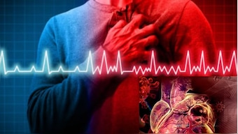 Undiagnosed heart conditions like arrhythmias or coronary artery disease can significantly increase the risk of sudden heart incidents during physical exertion.